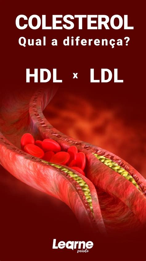 colesterol hdl baixo-4